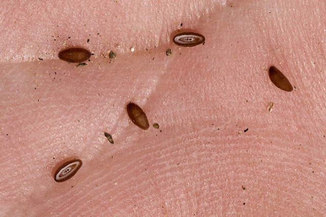 Small brown seeds